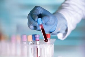 qatar prometric test for medical lab technician